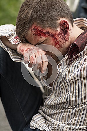 Injured man after car crash Stock Photo