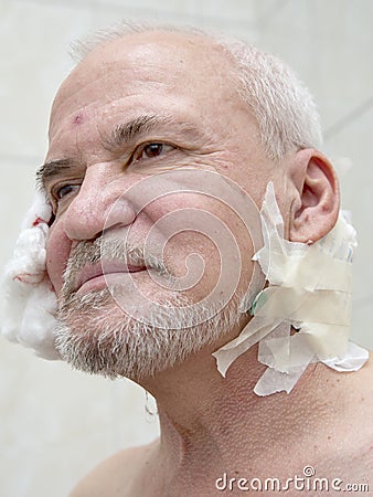 Injured old man Stock Photo