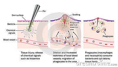 Injury and inflammation Vector Illustration