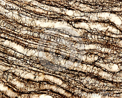 Kidney medulla. Reticular fibers Stock Photo