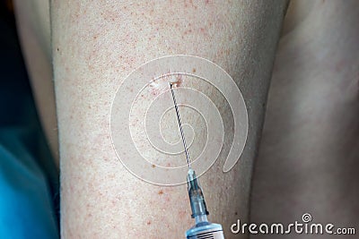 inoculation in the hand, vaccination, injection, syringe in the hands of a doctor, immunization coronavirus Stock Photo