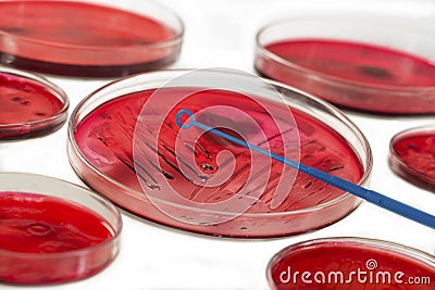 INOCULATION MICROBIOLOGY Stock Photo