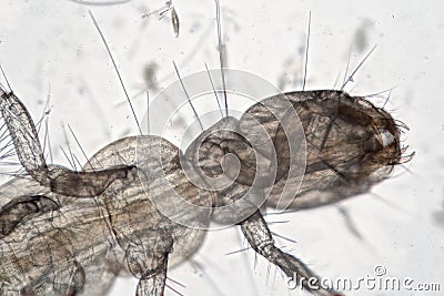 Insectophobia, larva Orthocladiinae of the mosquito family Chironomidae by microscope. Microscopic freshwater insect monster Stock Photo