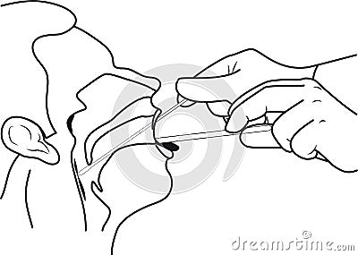 4-insert the throat swab into the mouth line Vector Illustration