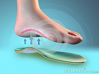 Foot arch support Cartoon Illustration