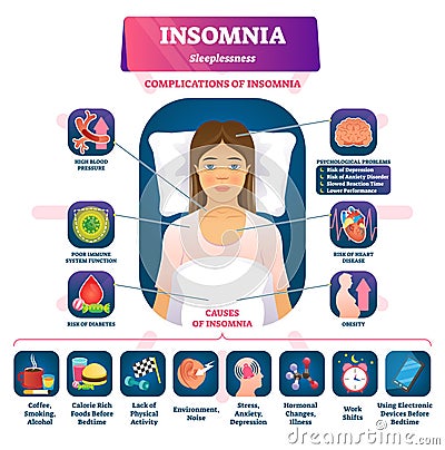 Insomnia vector illustration. labeled sleeplessness symptoms, causes scheme Vector Illustration