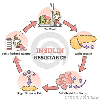 Insulin resistance pathological health condition educational outline diagram Vector Illustration