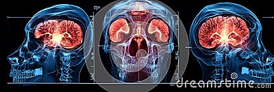 Intelligence Revolutionizing Medical Imaging Diagnostics for Early Disease Detection and Prevention:Advanced Algorithms Analyzing Stock Photo