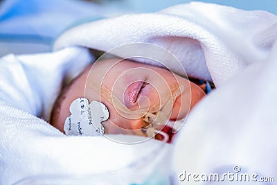 Intensive care, Child infant sedated and wrapped in blankets. Stock Photo