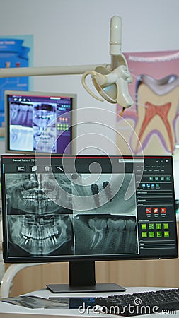 Interior of modern dentistry medical room with special equipment Editorial Stock Photo