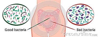 Intestinal bacteria flora. Good and bad bacterias. Vector Illustration