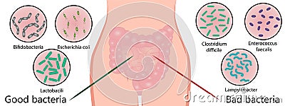 Intestinal bacterial flora. Good and bad bacterias. Vector Illustration