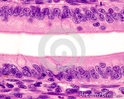 Intestinal epithelium. Brush border Stock Photo