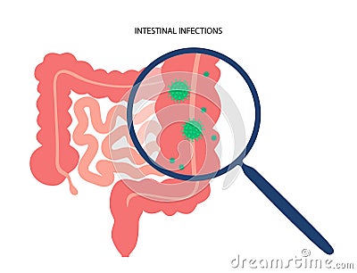 Intestinal infections disease Vector Illustration