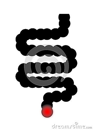 Intestine with hemorrhoid. Icon of hemorrhoids in bowel. Irritable pain in gut and rectal. Bacteria in stomach, bloating and Vector Illustration