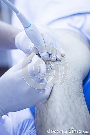 Intratissue percutaneous electrolysis Stock Photo