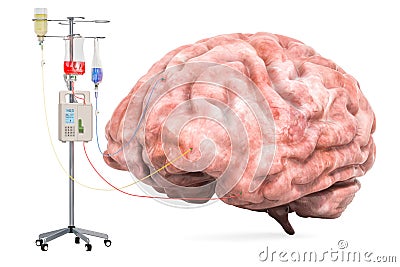 Intravenous therapy system with human brain. Treatment of Brain Diseases concept. 3D rendering Stock Photo