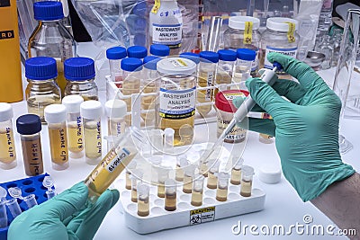 Investigation of sars-cov-2 virus in humans in a wastewater laboratory Stock Photo