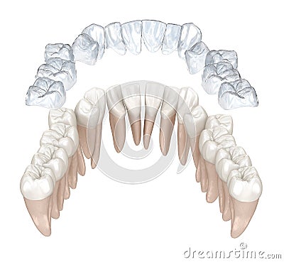 Invisalign braces or invisible retainer make bite correction. Medically accurate 3D animation Stock Photo