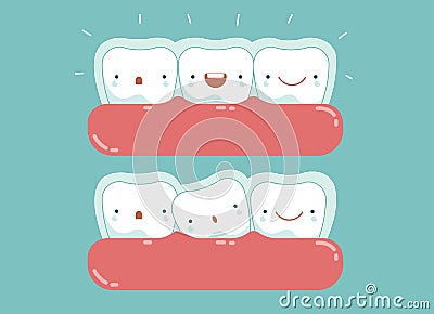 Invisible braces ,dental and tooth Vector Illustration