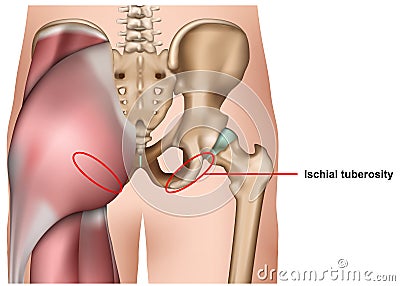 Ischial tuberosity 3d medical vector illustration isolated on white background infographic Vector Illustration