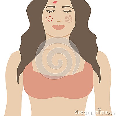 Isolated Girl with Skin Issues. Woman with Eczema, Acne and Melasma Skin Problems Vector Illustration