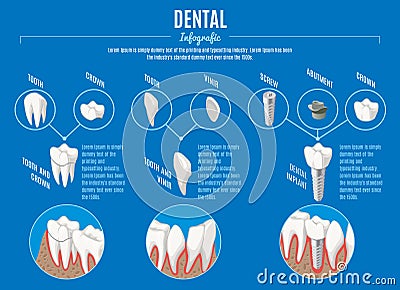 Isometric Prosthetic Dentistry Infographic Concept Vector Illustration