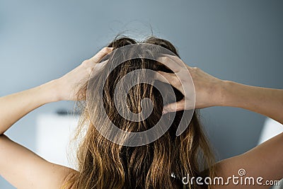Itching Dry Head Scalp Stock Photo