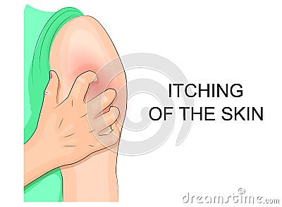 Itching of the skin, infection. hand combing shoulder Vector Illustration