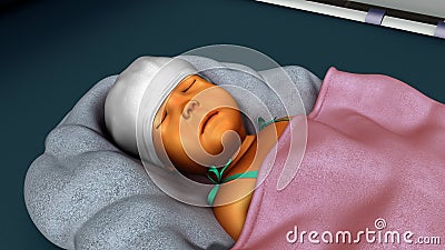 Jaundice in new born Stock Photo