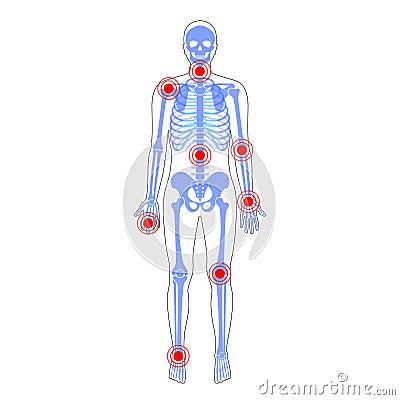 Joint pain on skeleton in human body Vector Illustration