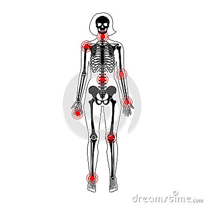 Joint pain on skeleton in human body Vector Illustration