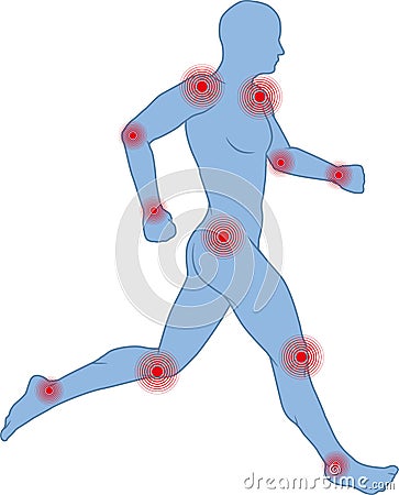 Joints pain Vector Illustration