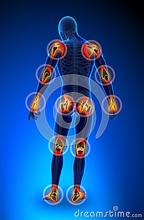 Joints pain - full figure Stock Photo