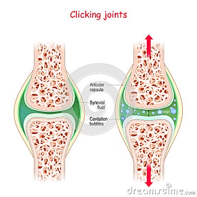 Joints and popping sound. Physiological Mechanism of cavitation Vector Illustration