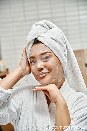 joyful asian woman with acne and Stock Photo