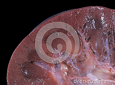 Kidney. Close-up Stock Photo