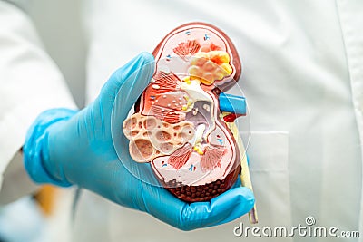 Kidney disease, Chronic kidney disease ckd, Doctor hold model to study and treat in hospital Stock Photo