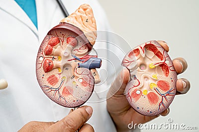 Kidney disease, Chronic kidney disease ckd, Doctor with human model to study and treat in hospital Stock Photo