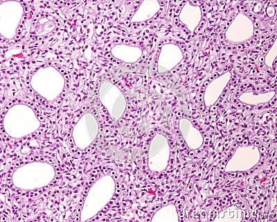 Kidney medulla. Papillary ducts Stock Photo