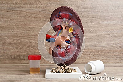 Kidney model with stones, urine sample and pills on wooden table Stock Photo