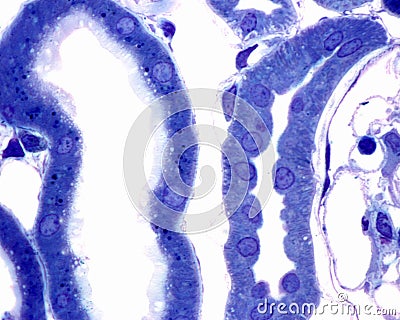 Kidney. Proximal and distal tubule Stock Photo