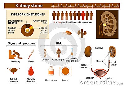 Kidney stone Vector Illustration