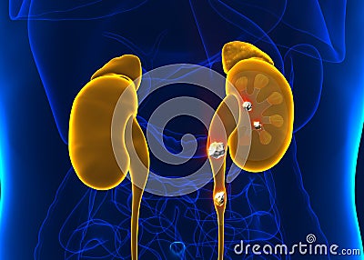 Kidney stones anatomy pain male internal organ painful cristaline mineral cross section - 3d illustration Cartoon Illustration