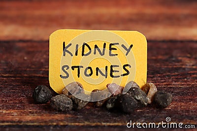 Kidney stones Stock Photo