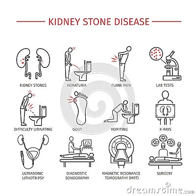 Kidney stones. Line icons set. Vector Illustration