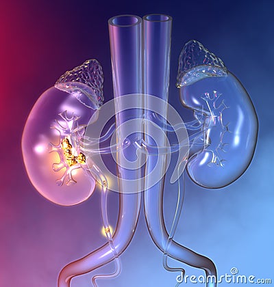 Kidney stones in minor and major calyces and ureter, colorful medically 3D illustration Stock Photo