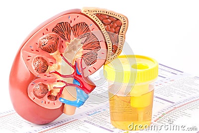 Kidney, urine sample and lab form Stock Photo