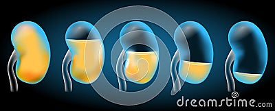 Kidneys and urine. Realistic transparent blue kidney on dark background Vector Illustration