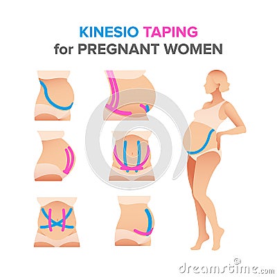 Kinesio taping illustrations for pregnant women Vector Illustration